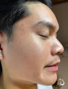 Jason After Jason After