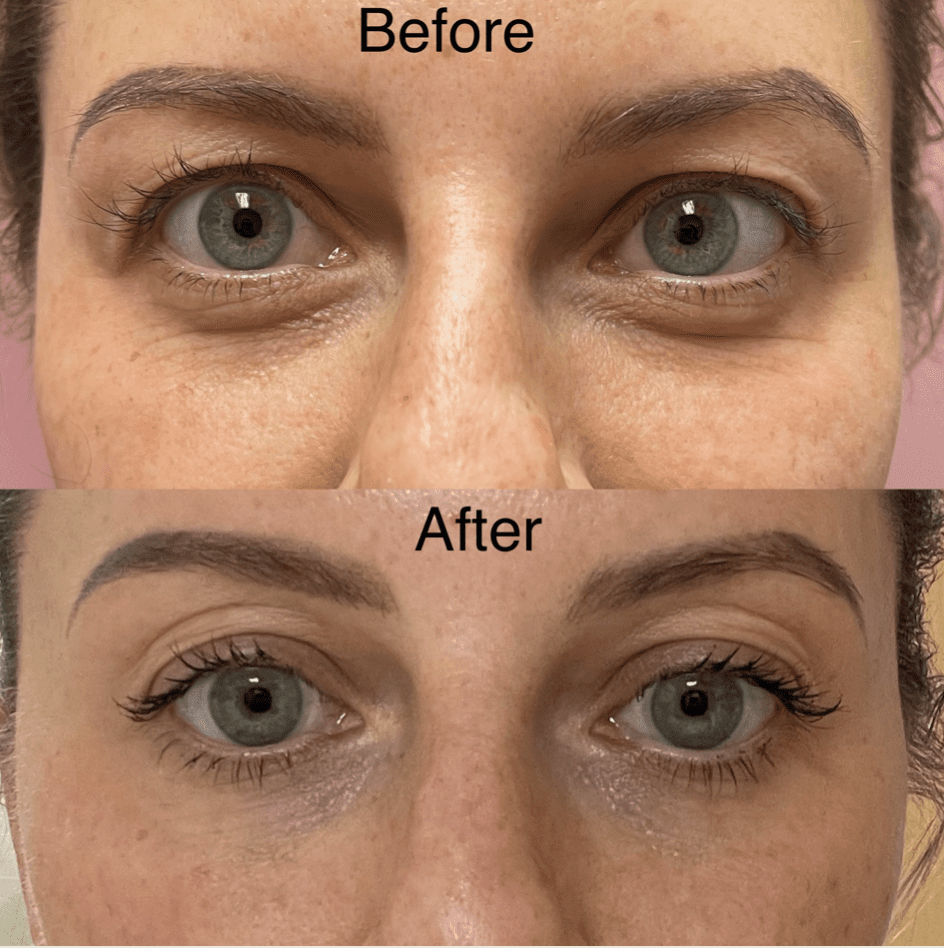 1772149758_NeoGen-PSR NeoGen PSR