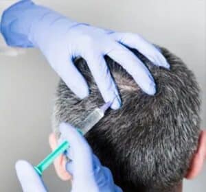 1772149775_Renew-You-Mobile-MedSpa-img-07-300x280 Renew You Mobile MedSpa img 07