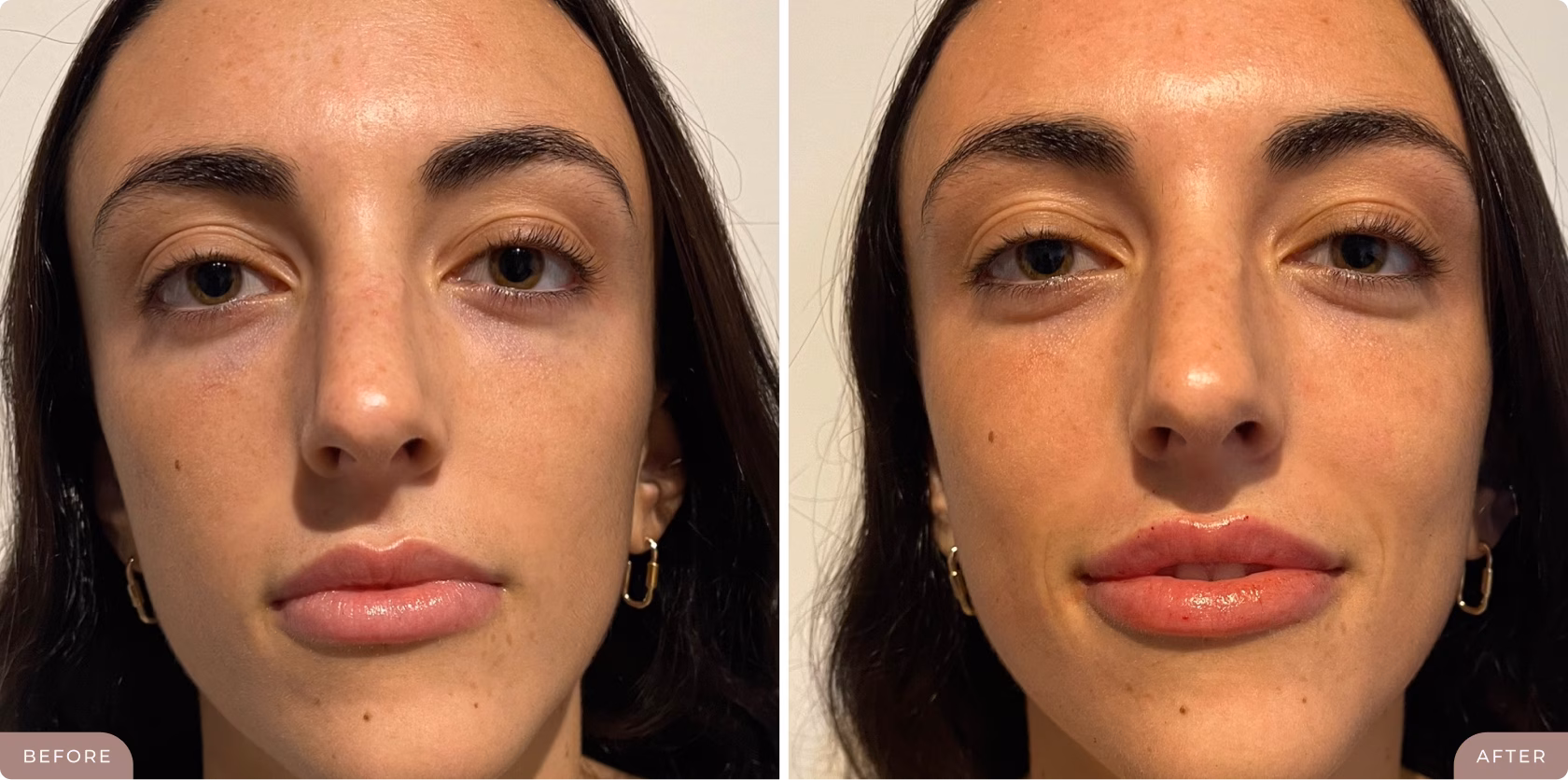 Before & After-img@1.2x_converted